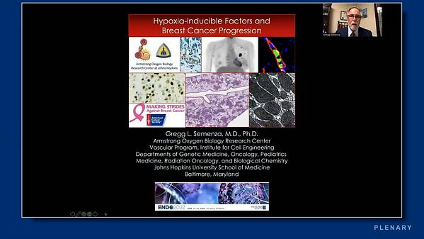 Underline Hypoxia Inducible Factors And Breast Cancer Progression 5005